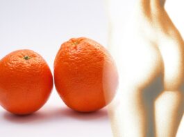 cellulite