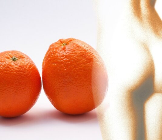 cellulite