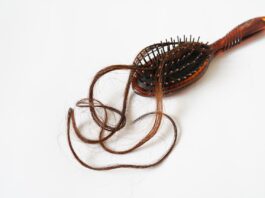 alopecia-rimedi-naturali
