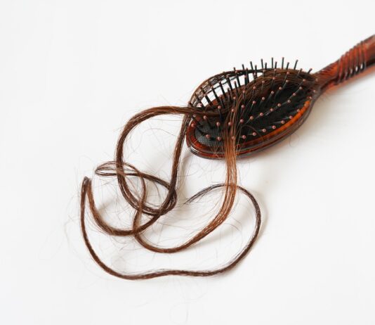 alopecia-rimedi-naturali