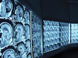 radiologia immagini