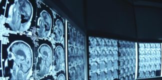 radiologia immagini