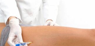 mesoterapia