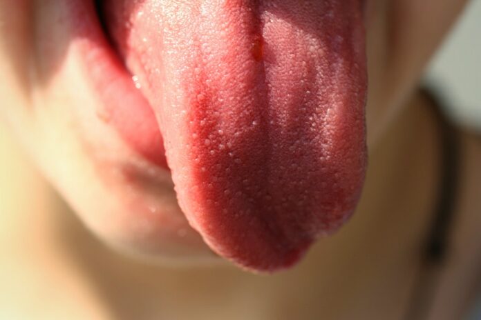 pulizia-della-lingua