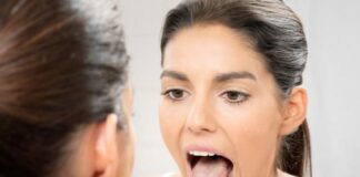 Mucosa orale