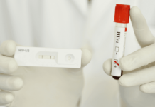 Test infezione HIV