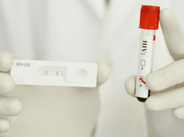 Test infezione HIV