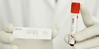Test infezione HIV