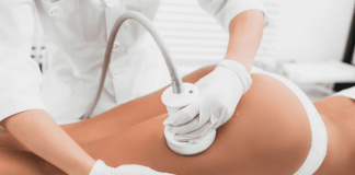 Laser Nir per cellulite