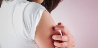 Eczema e dermatiti da contatto