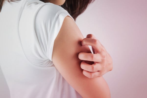 Eczema e dermatiti da contatto