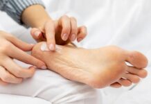 Rimedi naturali contro i piedi secchi e screpolati: dalla prevenzione alla cura