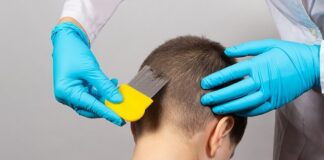 Come eliminare i pidocchi dai capelli senza trattamenti?
