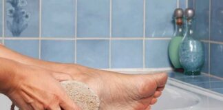 Calli e duroni, prevenzione e trattamenti migliori