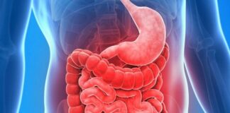 Permeabilità intestinale (leaky gut syndrome): cosa può causarla e come trattarla