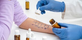 Istamina alimentare: cos’è l’intolleranza e come riconoscerla